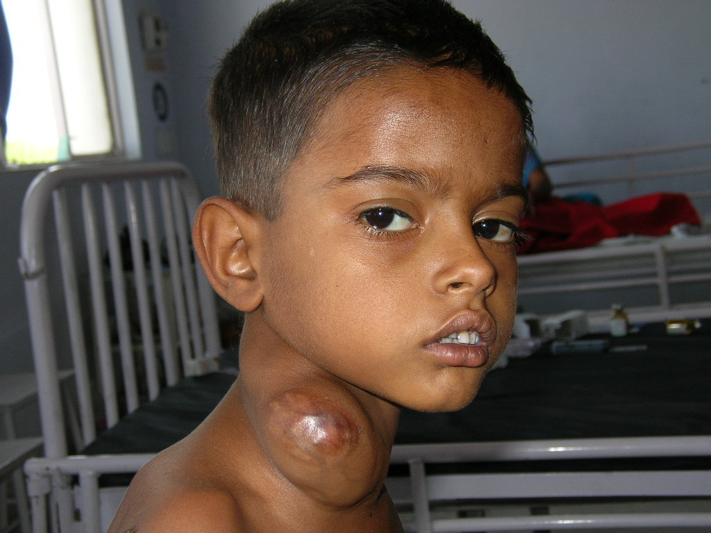 Pediatric Plastic Surgery Image 1